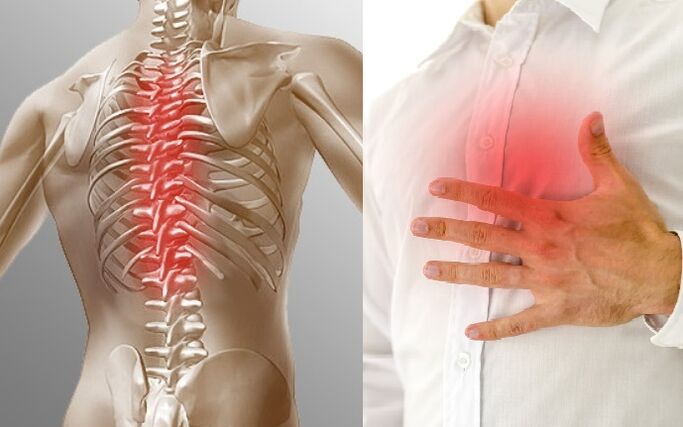 Léirítear osteochondrosis thoracic ag pian agus mothú tightness sa chófra