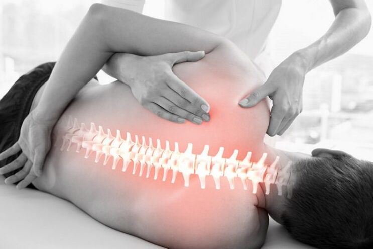 Seisiún teiripe láimhe le haghaidh osteochondrosis an spine chliabhraigh